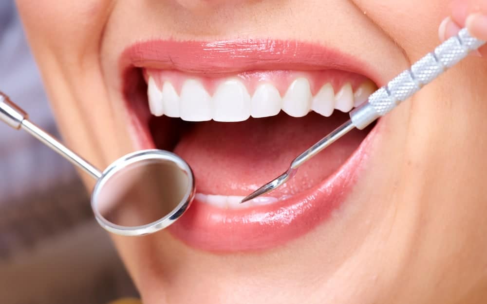Dental Cleanings