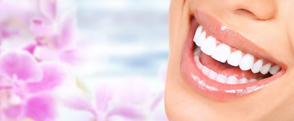 reduction free veneers