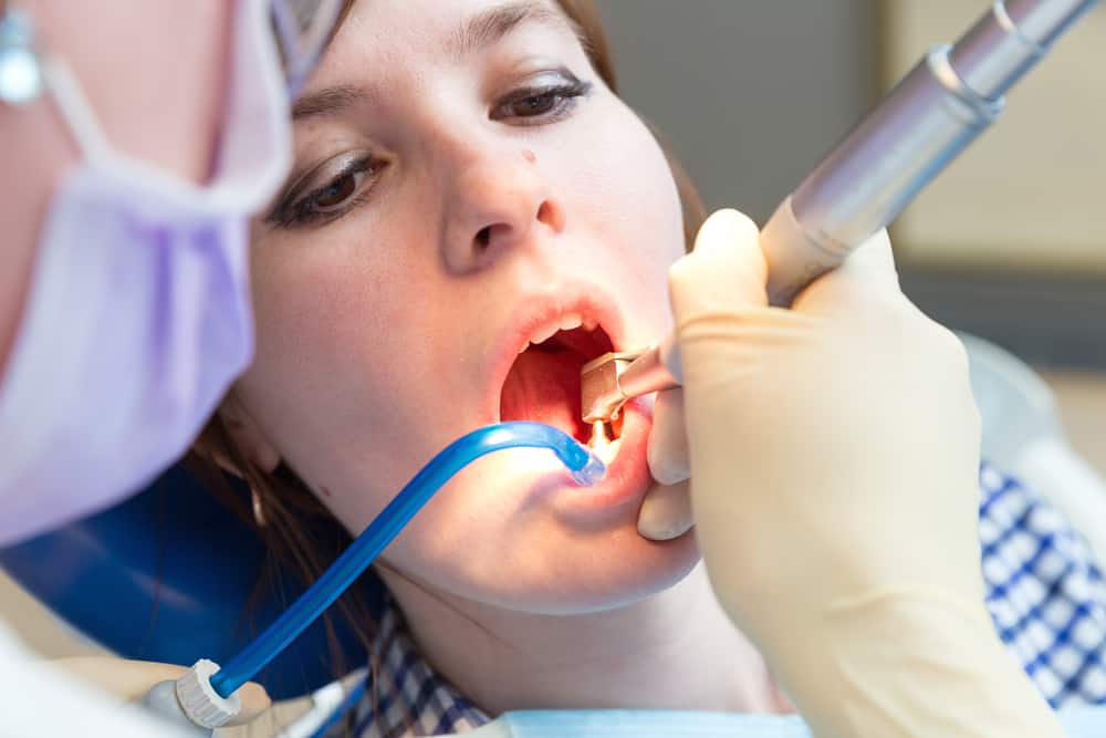 teeth cleaning